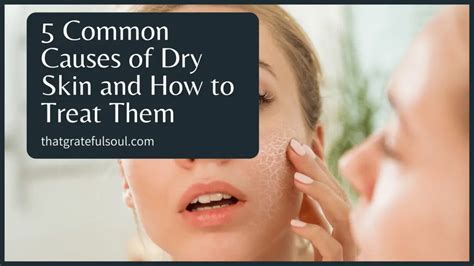 Common Causes Of Dry Skin And How To Treat Them