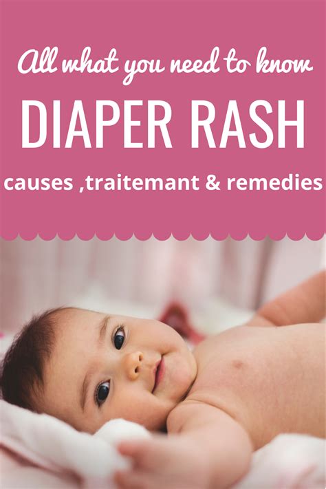 Diaper Rash Causes And Treatments That You Should Know In 2021
