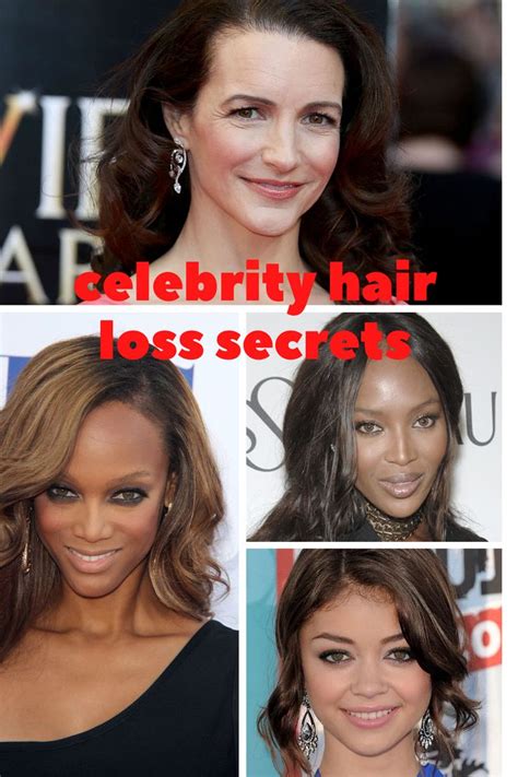 Hair Loss Hairstyles