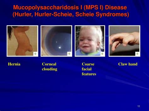 Sanfilippo syndrome is a type of rare form of lysosomal storage disease that is inherited in an autosomal recessive pattern. PPT - Mucopolysaccharides PowerPoint Presentation - ID:1158702