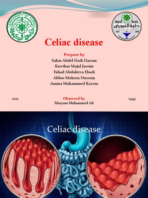 Celiac Disease Pdf Coeliac Disease Gluten