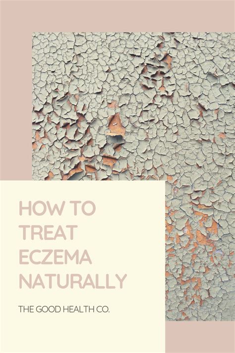 Treat Your Eczema Naturally By Finding The Root Cause Rather Than