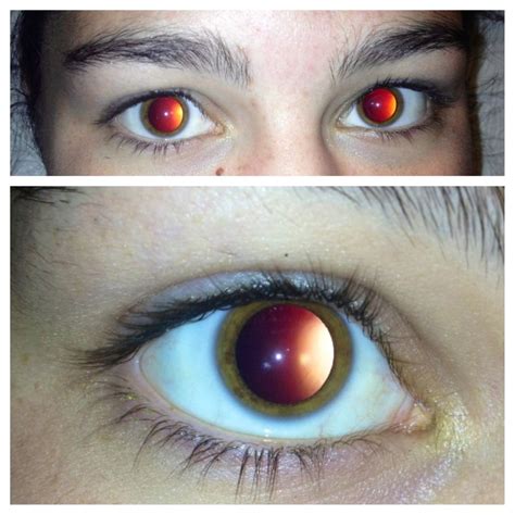 Girlfriend Just Got Back From An Eye Exam With Super Dilated Pupils