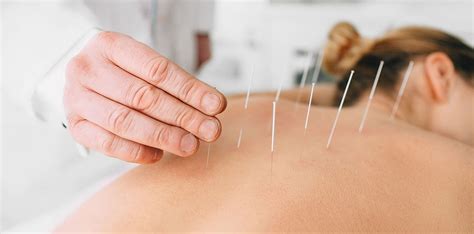 Acupuncture Treatment Dr Nedim Bakirci