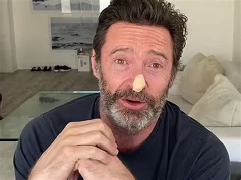 Hugh Jackman Undergoes Two More Biopsies Amid Ongoing Skin Cancer