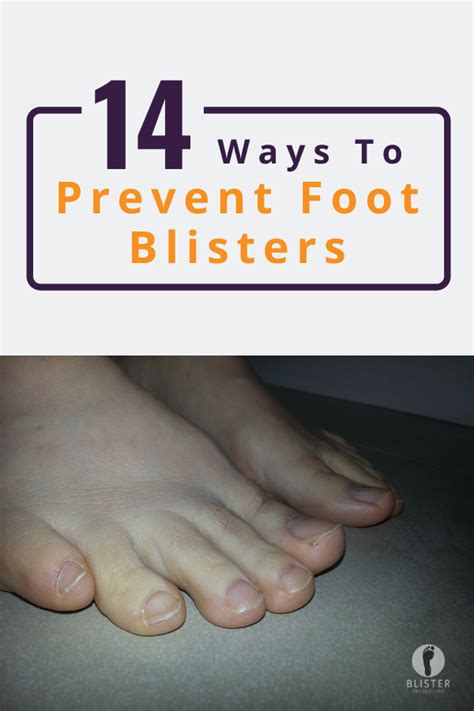 How To Prevent Blisters On Feet Prevention Blister Treatment