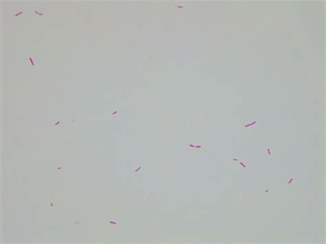 Micrograph Pseudomonas Putida Gram Stain 1000x P000174 Oer Commons