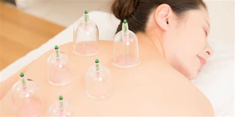 What Is Cupping Therapy Pt Health