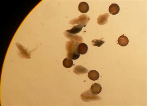 Artemia Eggs And Nauplii After Exposed To 75 Gpa For 24 H The Photo Download Scientific