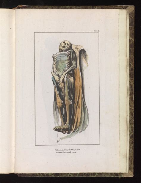 Illustration Of A Corpse Exhumed Two Months After Burial Wellcome