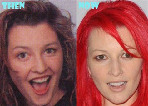 Did Jane Goldman Get Plastic Surgery For Breast Implants And Botox