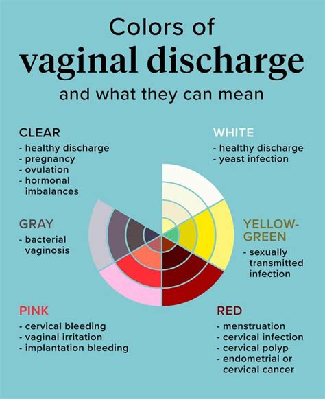 Is Vaginal Discharge A Small Matter