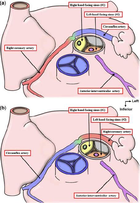 Right Ventricular Outflow Tract Anatomy