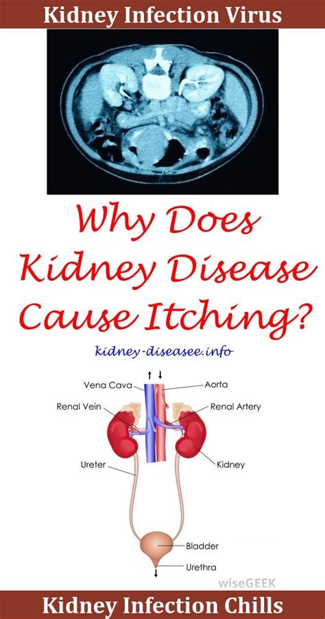 Kidney Transplant Quotes Kidney Infection Disease Quote Kidney