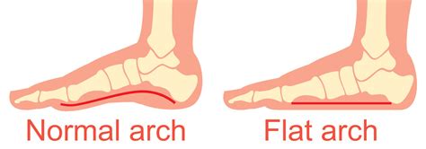 The Arches Of The Foot Longitudinal Transverse Teachmeanatomy