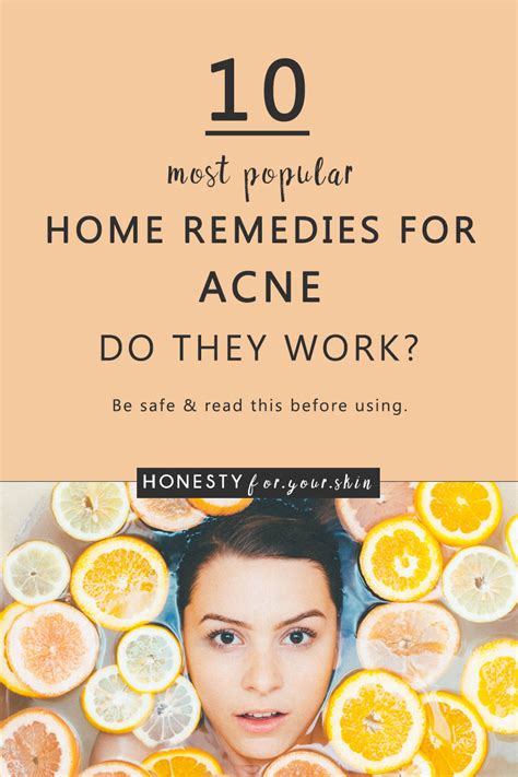 Home Remedies For Acne Honesty For Your Skin
