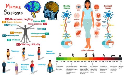 Multiple Sclerosis Overview Signs Symptoms Types