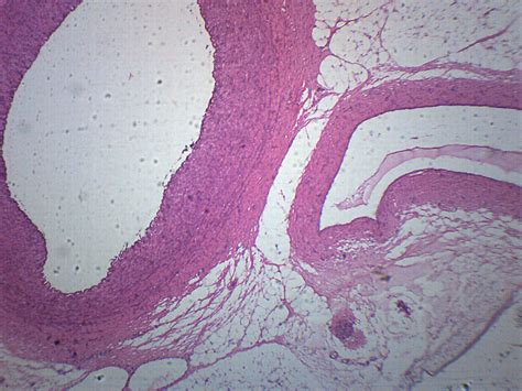 Human Artery Vein And Nerve Cross Section Prepared Microscope Slide — Eisco Labs