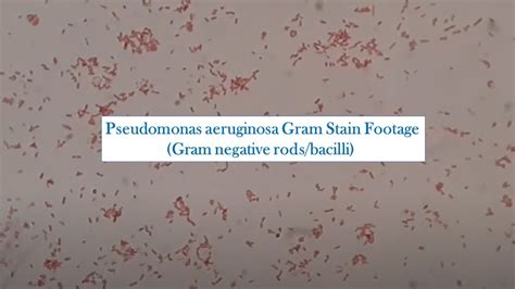 Gram Negative Rods Of Pseudomonas Aeruginosa Youtube