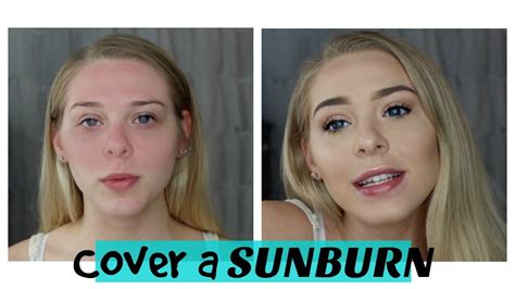 How To Cover A Sunburn Makeup Monday Lovey James Youtube