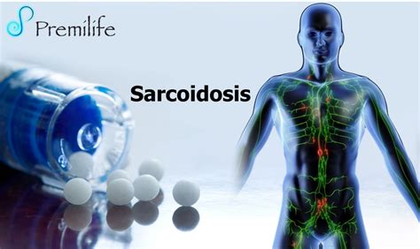 Sarcoidosis Premilife Homeopathic Remedies