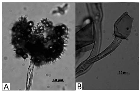 Microscopic Features Of Mucor Plumbeus A Sporangiophoro And Spores