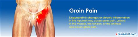 Groin Pain Types Symptoms Causes Treatment