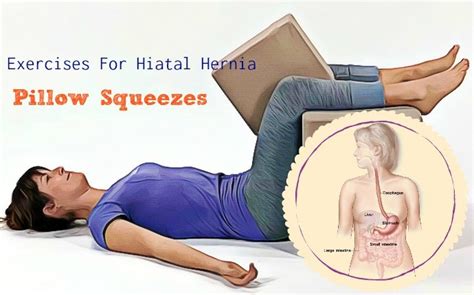 16 Safe Exercises For Hiatal Hernia To Follow Page 2
