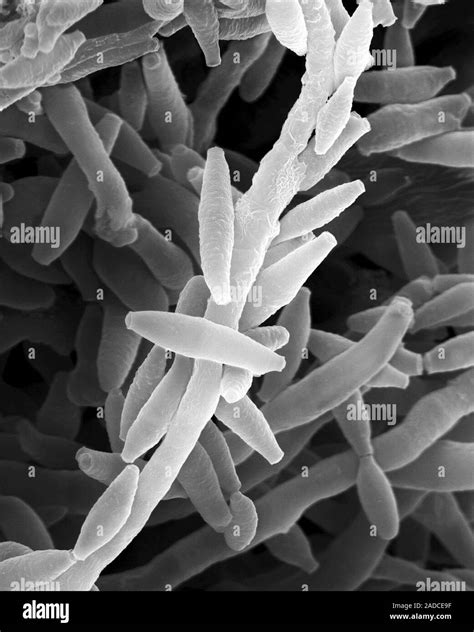 Scanning Electron Micrograph Sem Of Fungal Hyphae And Spores Of The