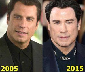 John Travolta Plastic Surgery Facelift Botox Hair Transplant