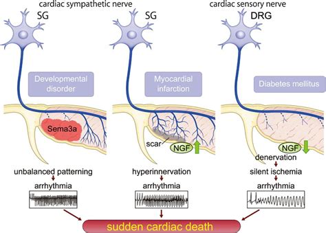 Cardiac Innervation and Sudden Cardiac Death | Circulation Research