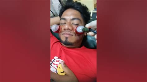 Hijama Therapycupping Therapy For Acne Pimplesskin Care Youtube