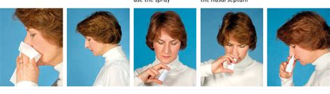 Figure 3 From How To Use A Corticosteroid Nasal Spray Semantic Scholar