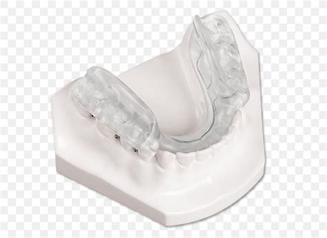 Splint Temporomandibular Joint Dysfunction Jaw Orthotics Twin Block