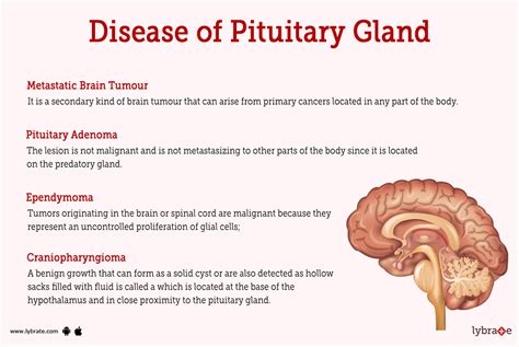 Pituitary Gland Brain