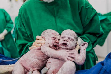 25 Images Capture The Emotional Moment When Newborn Twins Hug Each Other