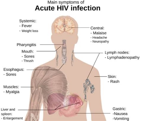HIV And Aids Symptoms Information Treatment Disabled World
