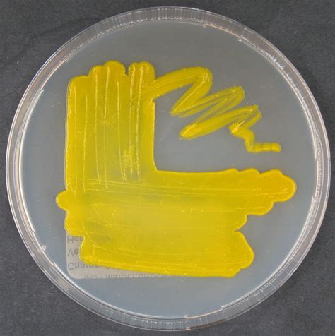 Mycobacterium Kansasii G133 Bostrom Type Strain Dsm 44162 Atcc