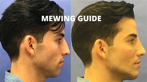 How Mewing Changed My Life Mewing Guide Get A Stronger Jawline