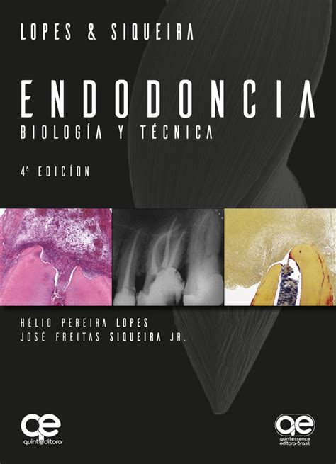 Lopes And Siqueira Endodoncia Biología Y Técnica Tienda Gaceta Dental