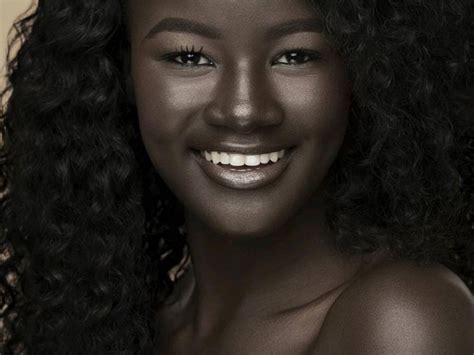 Bullies Mocked Khoudia Diops Dark Complexion And Now Shes A Huge