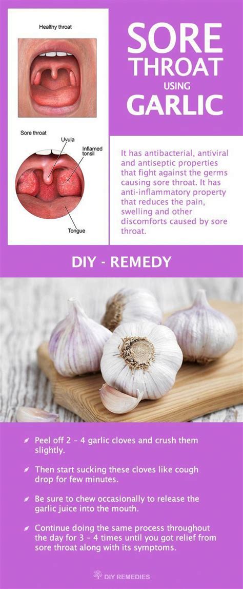 Get Rid Of Sore Throat Using Garlic Sore Throat Remedies Sore Throat