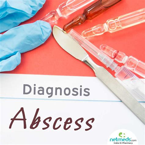 Abscess Causes Symptoms And Diagnosis