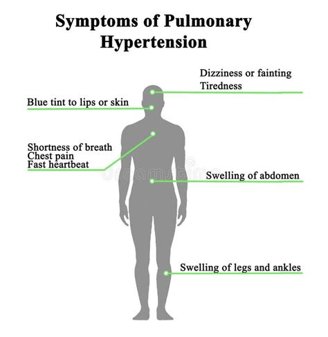 Pulmonary Hypertension Symptoms Causes And Treatment Tabitomo