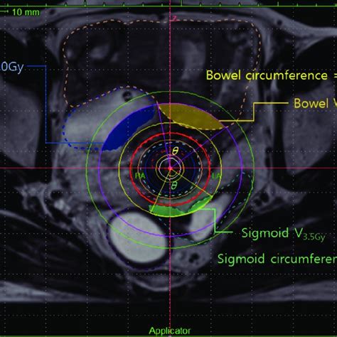Axial Magnetic Resonance Imaging Showing Outlines Of Anatomical
