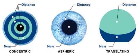 Varifocal Contact Lenses Multifocal Contacts Eyesite Opticians