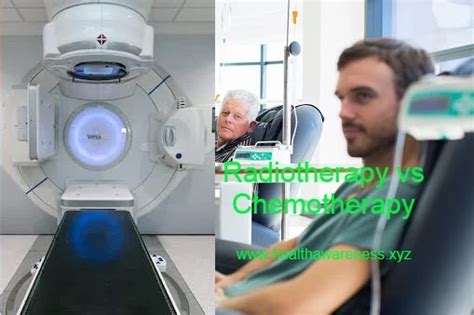 Radiotherapy Vs Chemotherapy