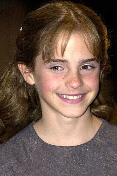 Emma Watson Before And After Emma Watson Emma Watson Beautiful