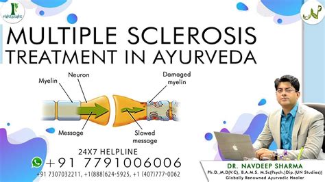 Multiple Sclerosis Treatment In Ayurveda Best Treatment Of Multiple