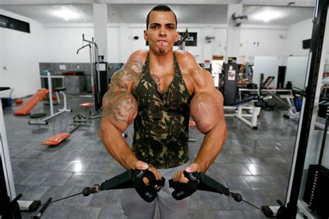 Real Life ‘hulk’ Almost Lost His Arms After Injecting Oil Into Muscles